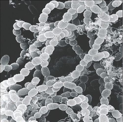 Sodobne tehnike ustne higiene - Med.Over.Net