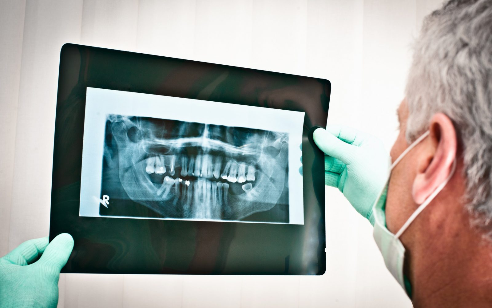 Zobozdravnik pregleduje zobne rentgenske posnetke.