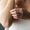 Ženska praskanje srbenje kože telesa