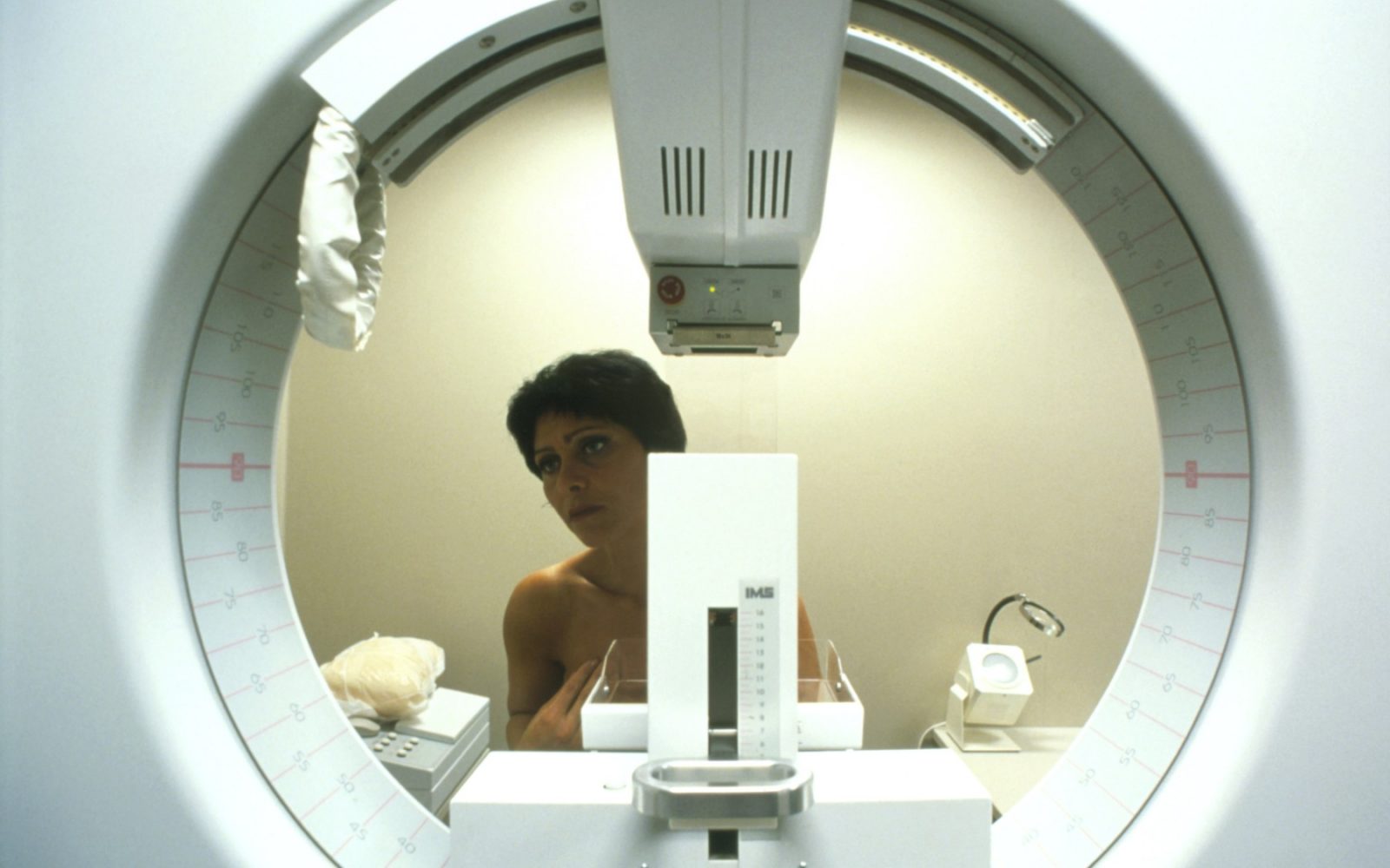 Mamografija: ženska na presejalnem pregledu dojk