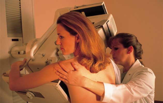 Pacientka med prejemanjem mamograma v sodobni medicinski kliniki. Slika prikazuje zdravstvenno delavko, ki upravlja z mamografsko napravo, medtem ko pacientka stoji ob stroju. Okolje je čisto in strokovno, kar poudarja pomembnost rednih pregledov za odkrivanje raka dojk. Ta visokoresolucijska slika je idealna za uporabo v medicinskih člankih, izobraževalnih gradivih in kampanjah za ozaveščanje o preprečevanju in diagnozi raka dojk.