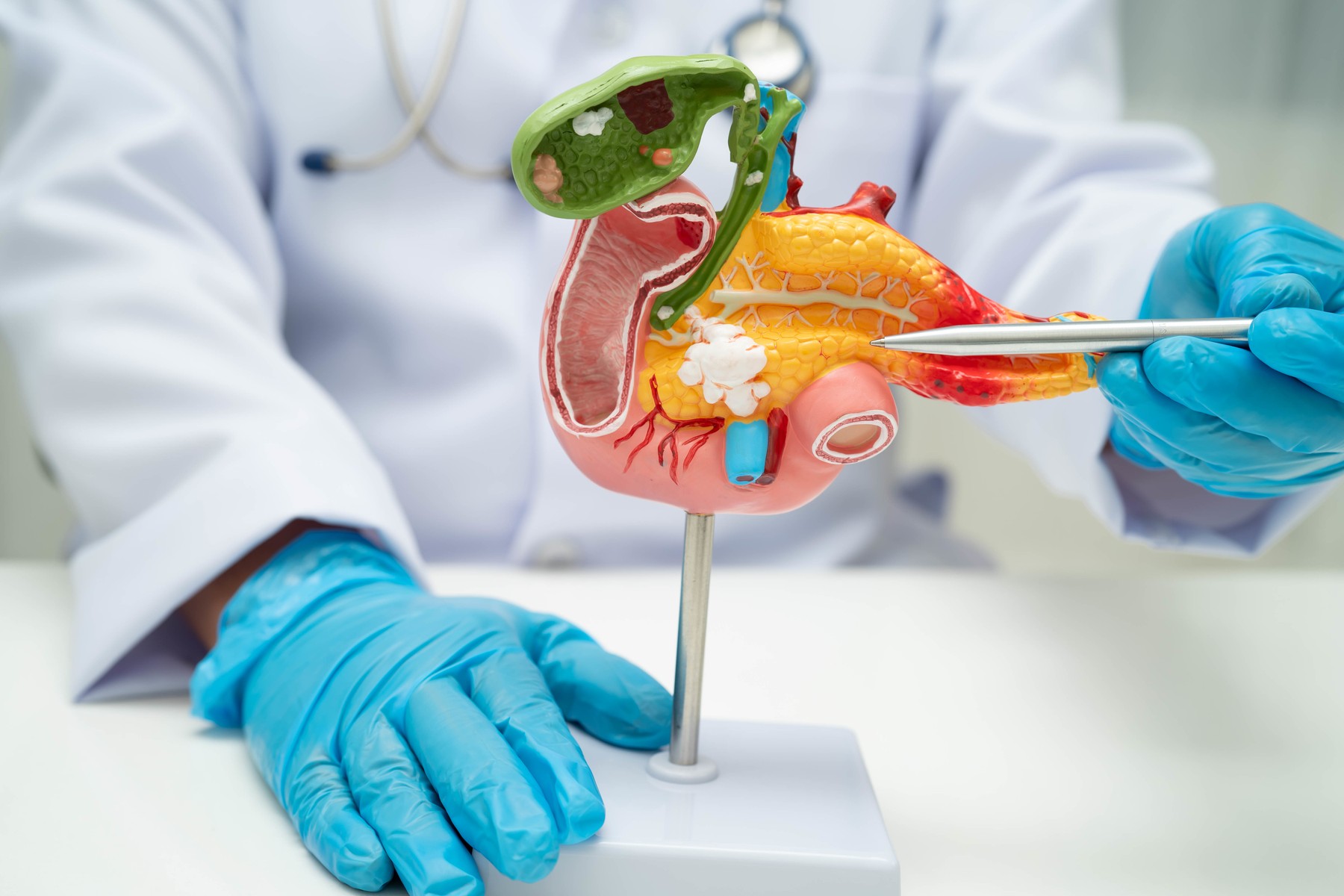 Model trebušne slinavke, ki ga uporablja zdravnik za razlago bolezni ali zdravljenja.