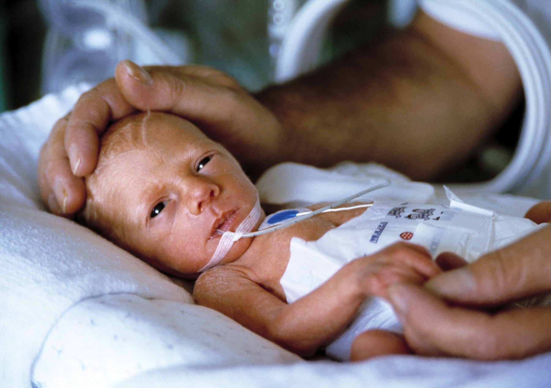 Nedonošenček v neonatalni intenzivni negi v inkubatorju, nežen dotik staršev na njegovi glavi.