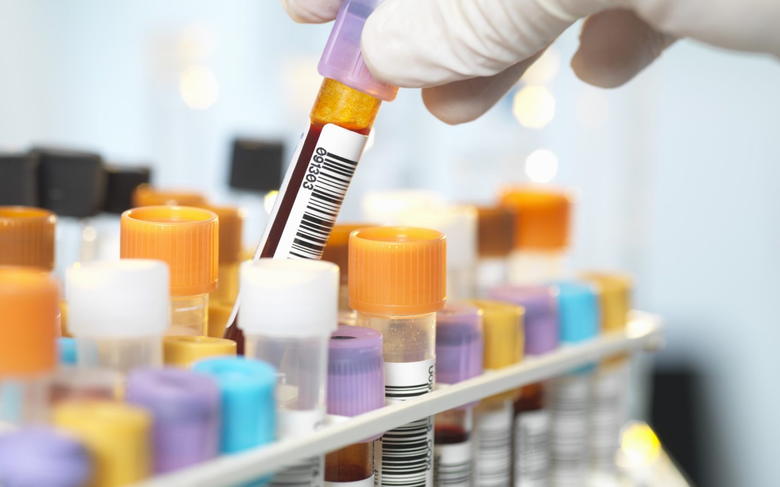 Laboratorijski test krvi – medicinski vzorci za analizo v epruvetah s črtno kodo.