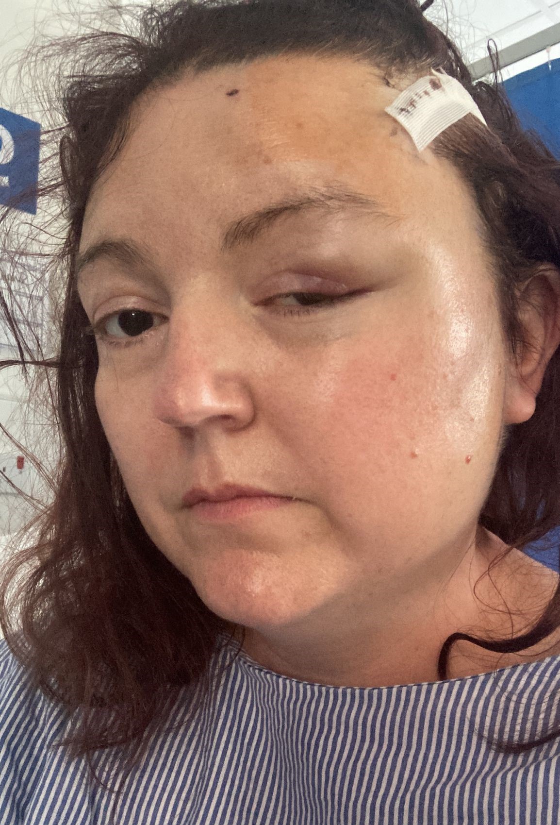 Sarah Hitchman, 43-letna učiteljica, ki je simptome možganskega tumorja sprva pripisovala perimenopavzi.