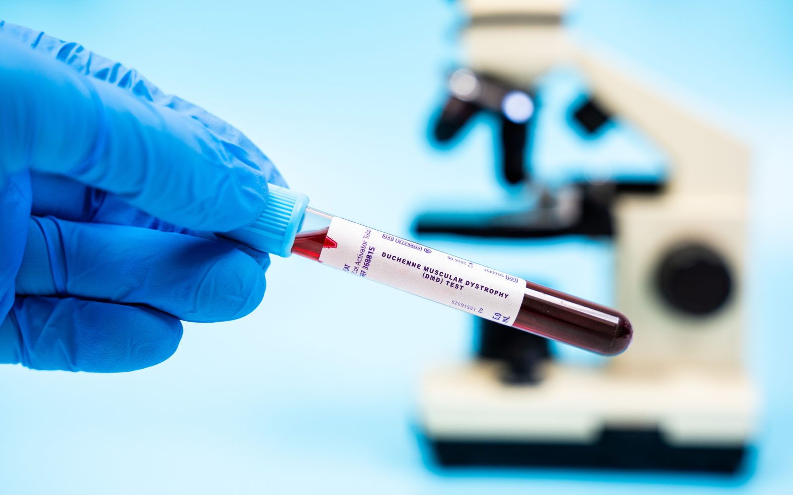 Krvni test za Duchennovo mišično distrofijo