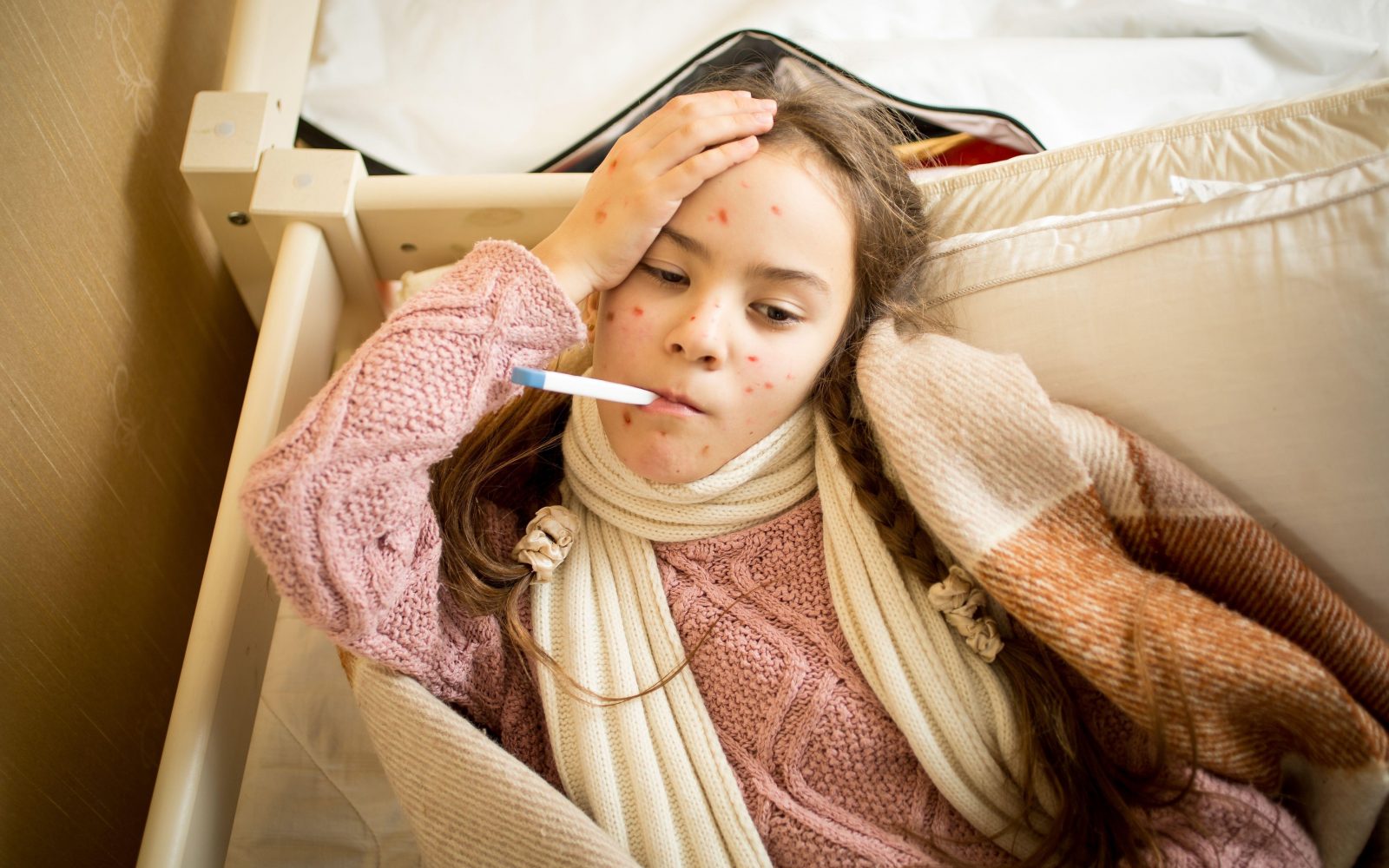 Otrok z noricami leži doma v postelji med okrevanjem, z vidnimi izpuščaji in vročino