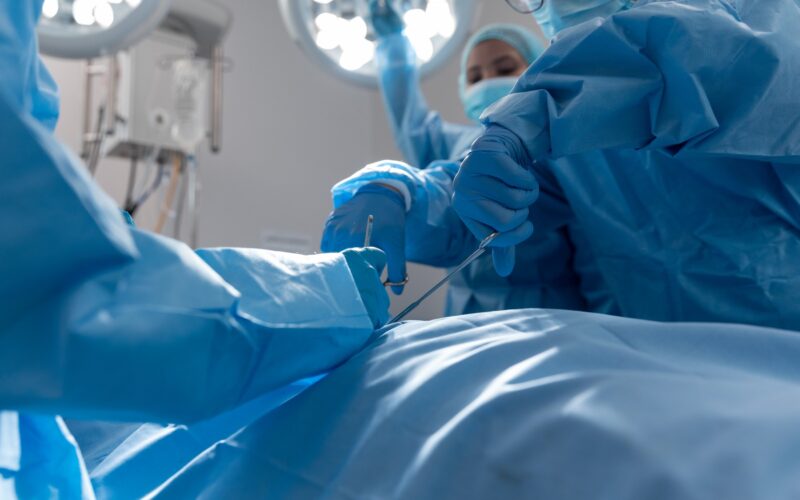 priprave na operacijo želodca - bariatrična kirurgija