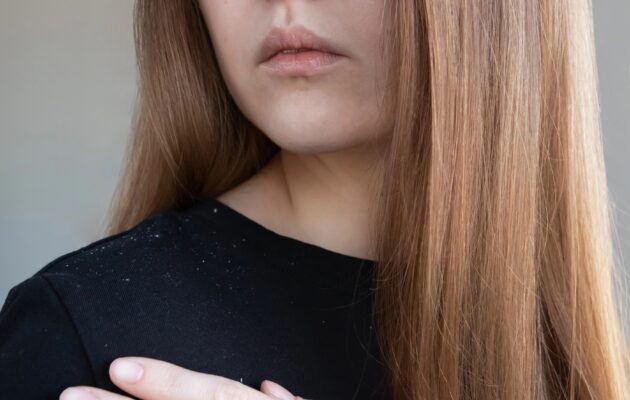 Lepa ženska z dolgimi lasmi, na puloverju pa so vidni sledovi prhljaja