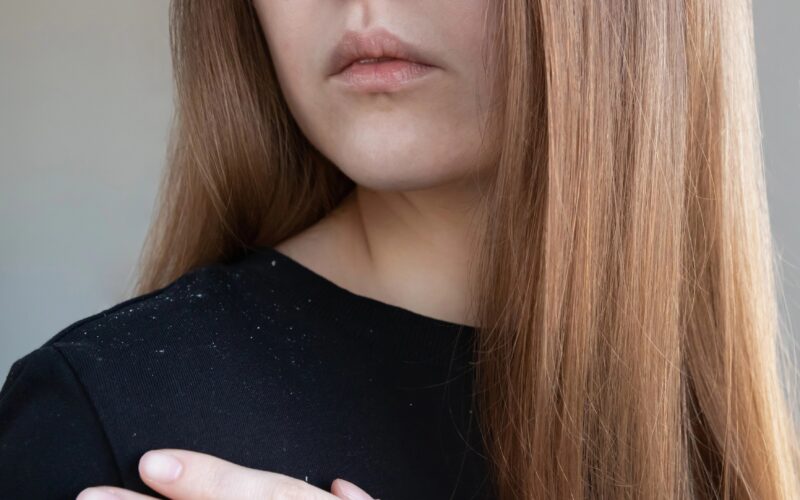 Lepa ženska z dolgimi lasmi, na puloverju pa so vidni sledovi prhljaja