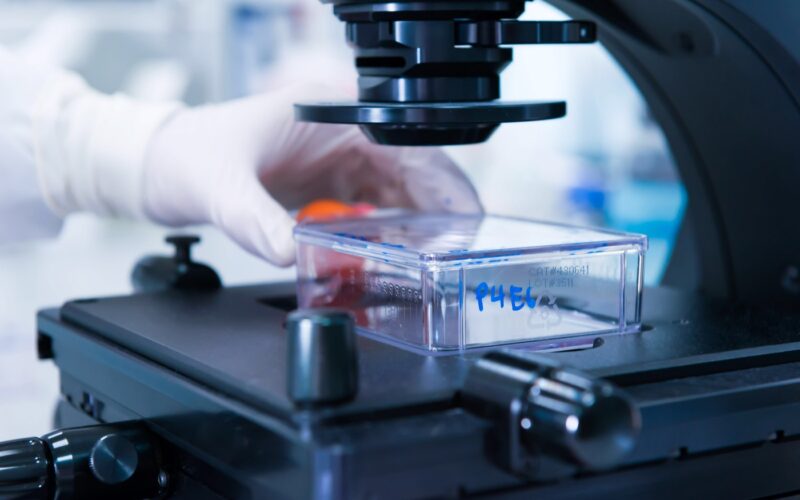 Napredna laboratorijska diagnostika raka v Sloveniji, ključna za dostop do sodobnega zdravljenja